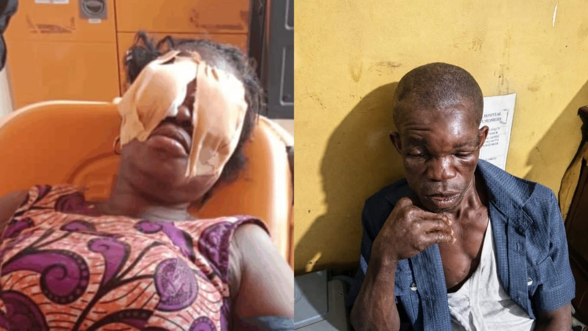 Brother Sentenced to 5 Years in Prison for Stabbing Sister in the Eye