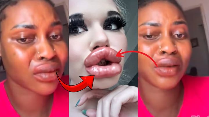 Lady Cries After Using 'Kayamata' Lip Gloss That Made Her Lips Swell Up